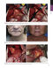 The Art and Science of Facelift Surgery 2nd Edition 2024