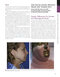The Art and Science of Facelift Surgery 2nd Edition 2024
