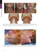 The Art and Science of Facelift Surgery 2nd Edition 2024