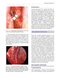 Logan Turner's Diseases of the Nose, Throat and Ear: Head and Neck Surgery, 12th Edition 12th Edition