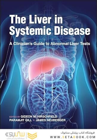 The Liver in Systemic Disease: A Clinician's Guide to Abnormal Liver Tests 1st Edition