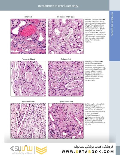 Diagnostic Pathology: Kidney Diseases 4th Edicion 2023