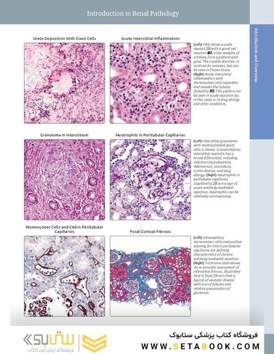 Diagnostic Pathology: Kidney Diseases 4th Edicion 2023
