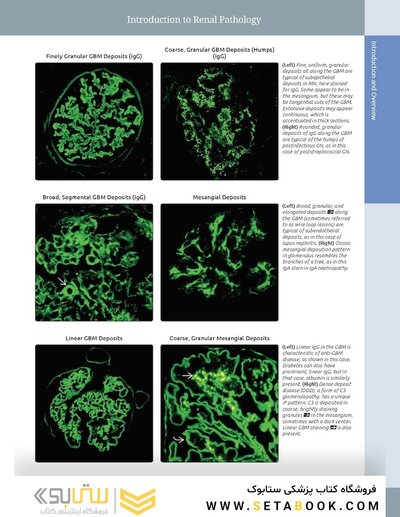 Diagnostic Pathology: Kidney Diseases 4th Edicion 2023