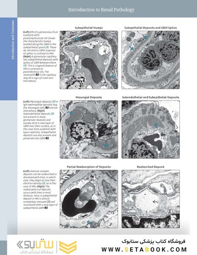 Diagnostic Pathology: Kidney Diseases 4th Edicion 2023