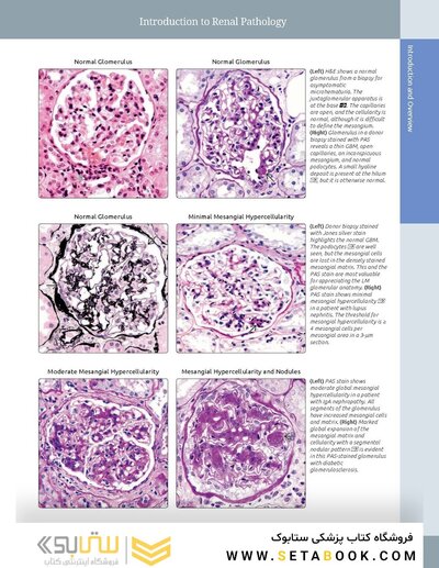 Diagnostic Pathology: Kidney Diseases 4th Edicion 2023