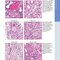 Diagnostic Pathology: Kidney Diseases 4th Edicion 2023