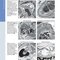 Diagnostic Pathology: Kidney Diseases 4th Edicion 2023