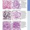 Diagnostic Pathology: Kidney Diseases 4th Edicion 2023