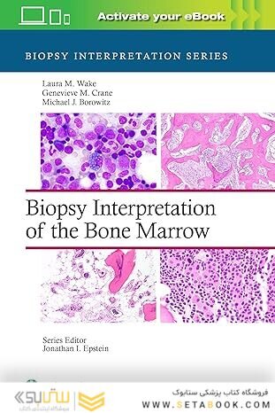 Biopsy Interpretation of the Bone Marrow First Edition