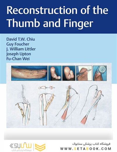 Reconstruction of the Thumb and Finger