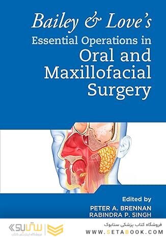 Bailey & Love's Essential Operations in Oral & Maxillofacial Surgery 1st Edition
