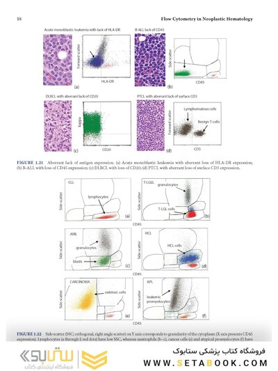 Flow Cytometry in Neoplastic Hematology: Morphologic-Immunophenotypic-Genetic Correlation 4th Edition