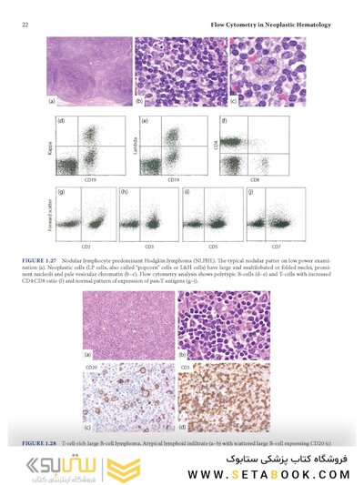 Flow Cytometry in Neoplastic Hematology: Morphologic-Immunophenotypic-Genetic Correlation 4th Edition