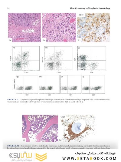 Flow Cytometry in Neoplastic Hematology: Morphologic-Immunophenotypic-Genetic Correlation 4th Edition