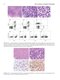 Flow Cytometry in Neoplastic Hematology: Morphologic-Immunophenotypic-Genetic Correlation 4th Edition