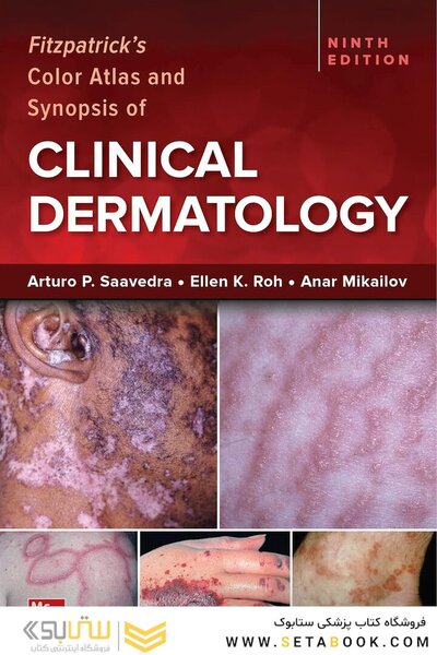 Fitzpatrick's Color Atlas and Synopsis of Clinical Dermatology, Ninth Edition 2024