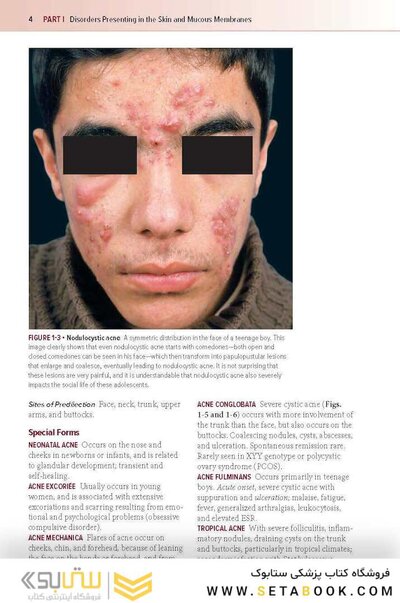Fitzpatrick's Color Atlas and Synopsis of Clinical Dermatology, Ninth Edition 2024
