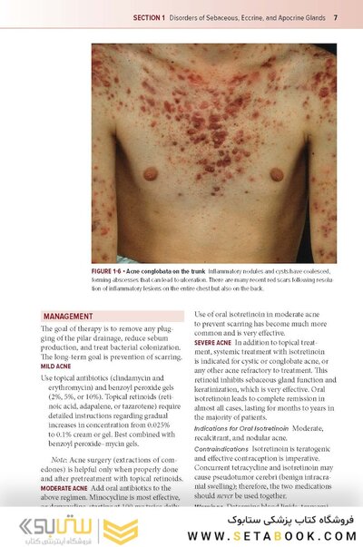 Fitzpatrick's Color Atlas and Synopsis of Clinical Dermatology, Ninth Edition 2024