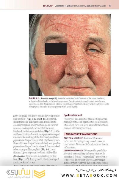 Fitzpatrick's Color Atlas and Synopsis of Clinical Dermatology, Ninth Edition 2024