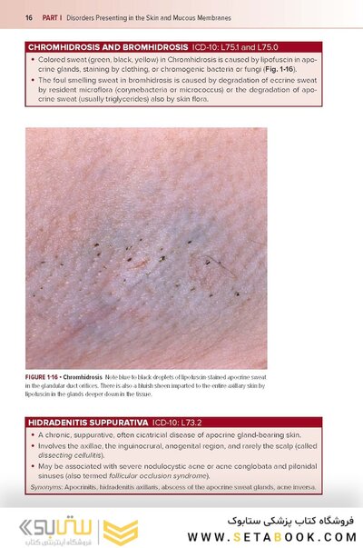 Fitzpatrick's Color Atlas and Synopsis of Clinical Dermatology, Ninth Edition 2024