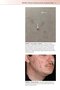 Fitzpatrick's Color Atlas and Synopsis of Clinical Dermatology, Ninth Edition 2024