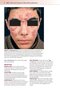 Fitzpatrick's Color Atlas and Synopsis of Clinical Dermatology, Ninth Edition 2024