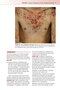 Fitzpatrick's Color Atlas and Synopsis of Clinical Dermatology, Ninth Edition 2024