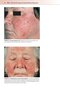Fitzpatrick's Color Atlas and Synopsis of Clinical Dermatology, Ninth Edition 2024