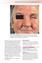 Fitzpatrick's Color Atlas and Synopsis of Clinical Dermatology, Ninth Edition 2024