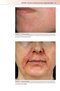 Fitzpatrick's Color Atlas and Synopsis of Clinical Dermatology, Ninth Edition 2024