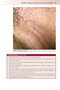 Fitzpatrick's Color Atlas and Synopsis of Clinical Dermatology, Ninth Edition 2024