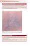 Fitzpatrick's Color Atlas and Synopsis of Clinical Dermatology, Ninth Edition 2024