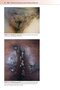 Fitzpatrick's Color Atlas and Synopsis of Clinical Dermatology, Ninth Edition 2024