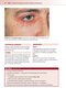 Fitzpatrick's Color Atlas and Synopsis of Clinical Dermatology, Ninth Edition 2024