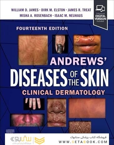 Andrews' Diseases of the Skin: Clinical Dermatology, 14th Edition