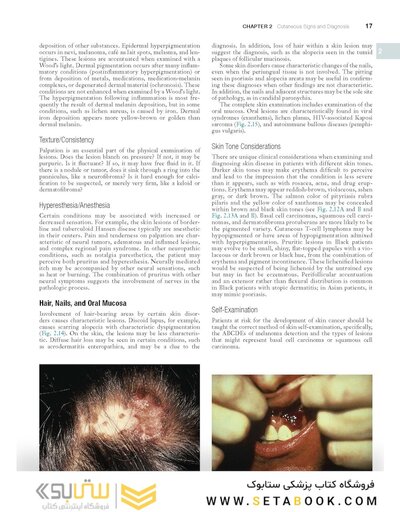 Andrews' Diseases of the Skin: Clinical Dermatology, 14th Edition