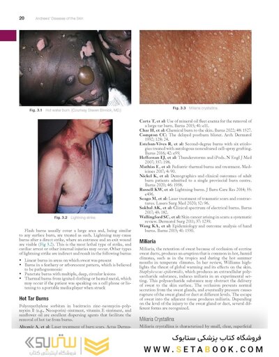 Andrews' Diseases of the Skin: Clinical Dermatology, 14th Edition