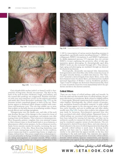 Andrews' Diseases of the Skin: Clinical Dermatology, 14th Edition