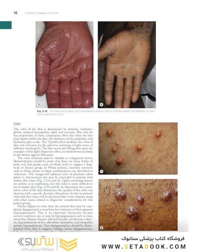 Andrews' Diseases of the Skin: Clinical Dermatology, 14th Edition