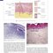Andrews' Diseases of the Skin: Clinical Dermatology, 14th Edition