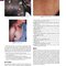 Andrews' Diseases of the Skin: Clinical Dermatology, 14th Edition