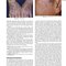 Andrews' Diseases of the Skin: Clinical Dermatology, 14th Edition