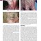 Andrews' Diseases of the Skin: Clinical Dermatology, 14th Edition
