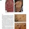 Andrews' Diseases of the Skin: Clinical Dermatology, 14th Edition