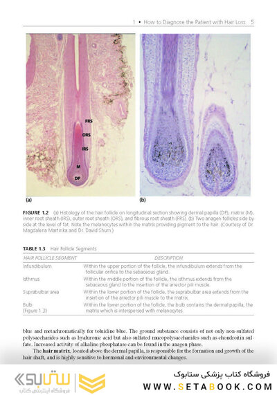 Hair Loss and Restoration 3rd Edition