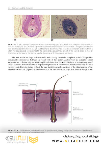 Hair Loss and Restoration 3rd Edition