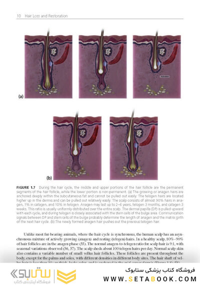 Hair Loss and Restoration 3rd Edition