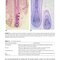 Hair Loss and Restoration 3rd Edition