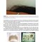 Hair Loss and Restoration 3rd Edition